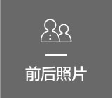 전후사진
