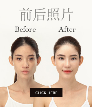 비포애프터