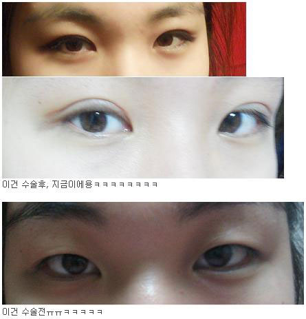 관련이미지