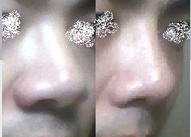 관련이미지