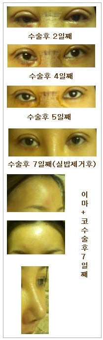 관련이미지