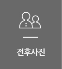 전후사진