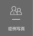 전후사진
