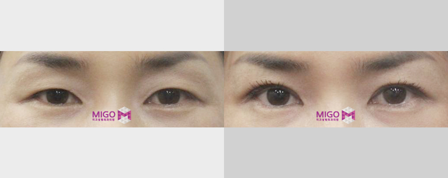 file1