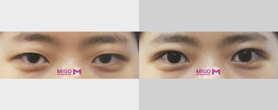 file1