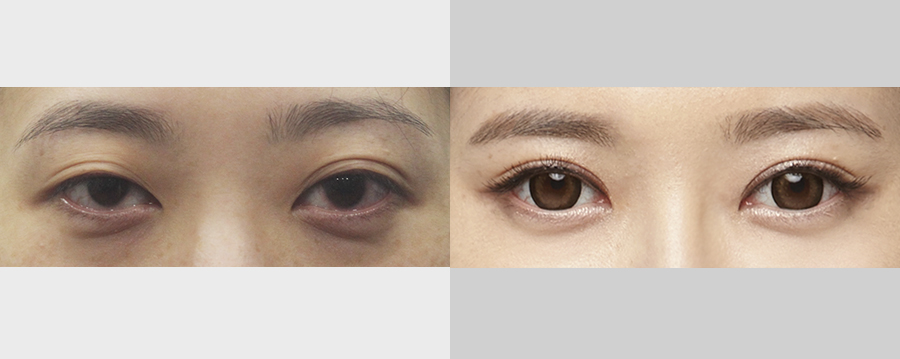 file1